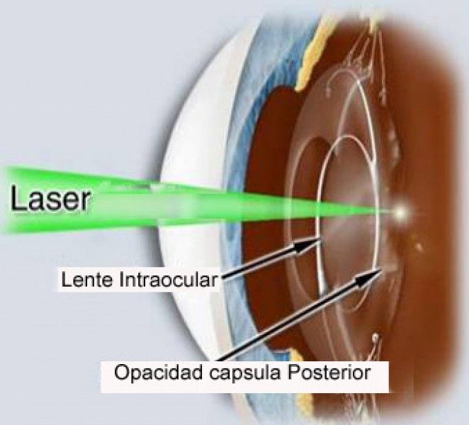 Clnica de Olhos Tomazelli  Oftalmologia Geral, Exames e Cirurgias -