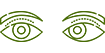 Clnica de Olhos Tomazelli  Oftalmologia Geral, Exames e Cirurgias Estrabismo Falha no posicionamento dos olhos, podendo o desvio ser para dentro e para fora ou para cima e para baixo.  